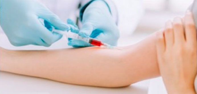 Image Service Contract Research Service